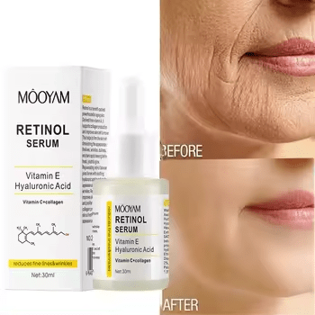 Serum 2